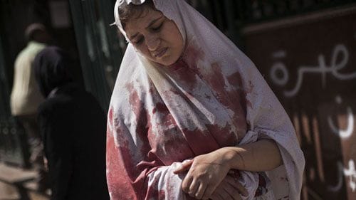 mujer siria herida manu brbao