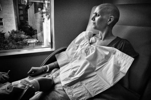 recibiendo tratamiento de quimioterapia en el hospital